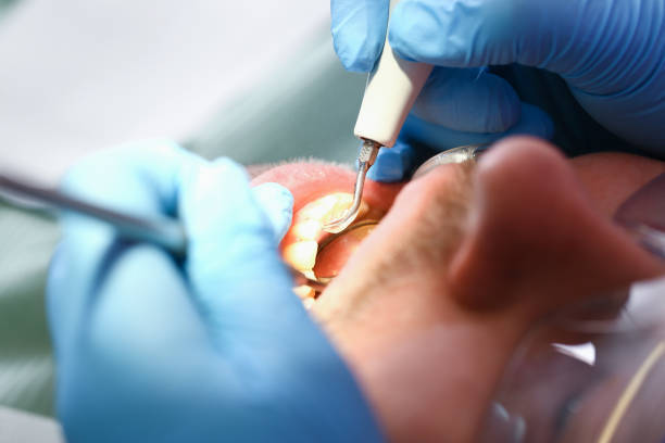 Best Emergency Treatment for Toothache in Benton, AR